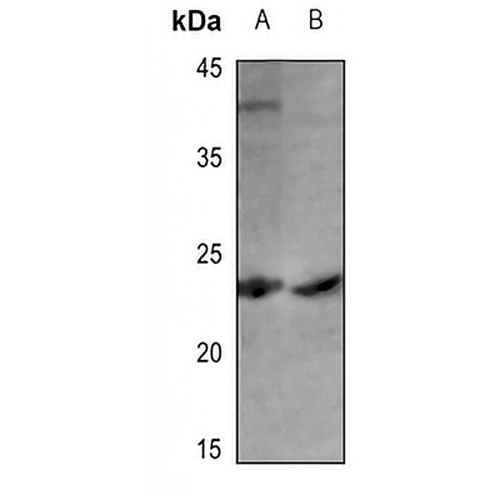 Cerebellin 1 Rabbit Polyclonal Antibody