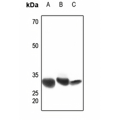 CBR1 Rabbit Polyclonal Antibody