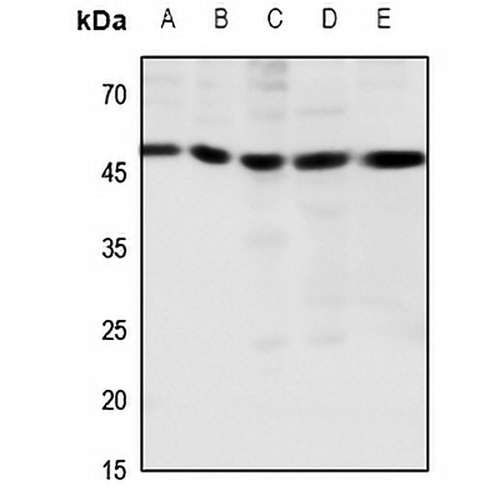 CCKBR Rabbit Polyclonal Antibody