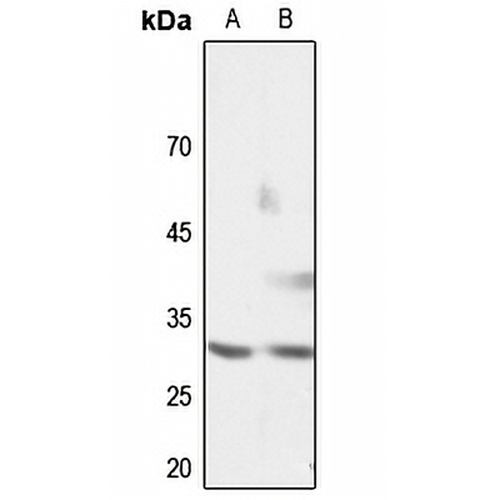Cyclin G1 Rabbit Polyclonal Antibody