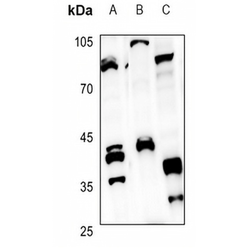 CD1e Rabbit Polyclonal Antibody