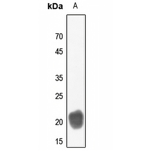 CD3d Rabbit Polyclonal Antibody