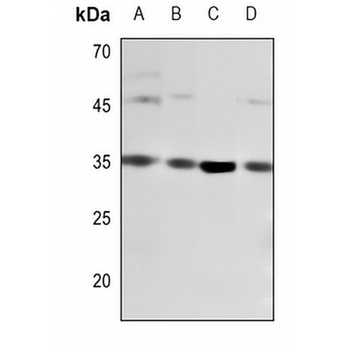 CD8a Rabbit Polyclonal Antibody