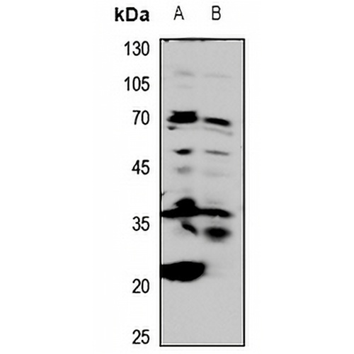 CD20 Rabbit Polyclonal Antibody