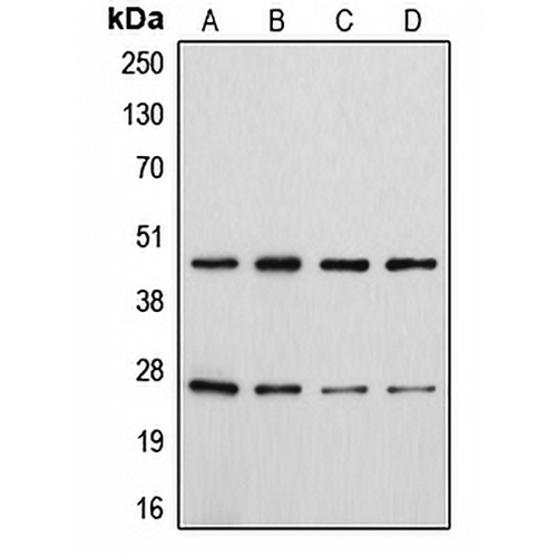 CD28 (Phospho-Y218) Rabbit Polyclonal Antibody