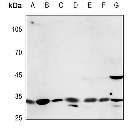 CD58 Rabbit Polyclonal Antibody