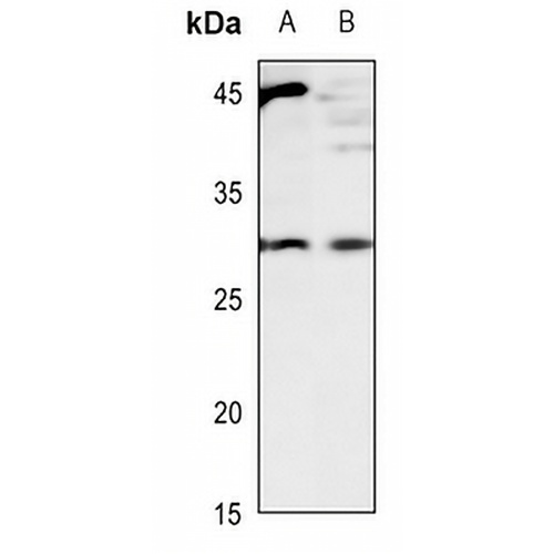 CD70 Rabbit Polyclonal Antibody