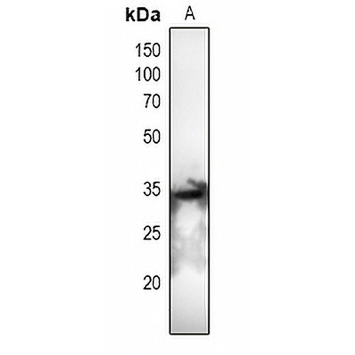 CDC2 (Phospho-T161) Rabbit Polyclonal Antibody