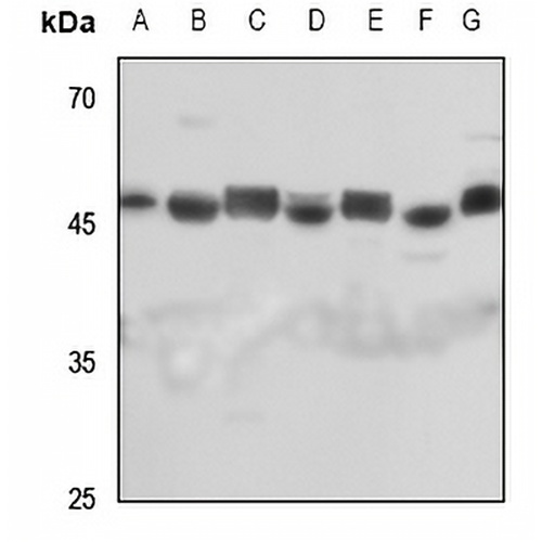 Septin 7 Rabbit Polyclonal Antibody