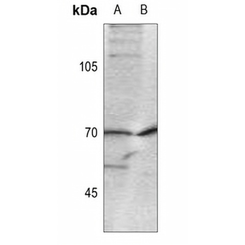 CDC25A (Phospho-S124) Rabbit Polyclonal Antibody