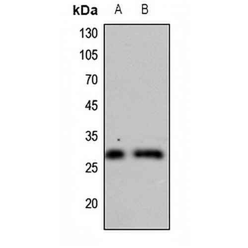 CDC34 Rabbit Polyclonal Antibody