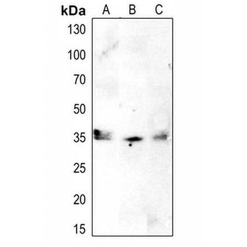 CDK1/2/3 (Phospho-T14) Rabbit Polyclonal Antibody