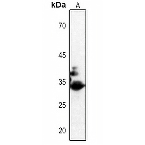 CDK2 (Phospho-T160) Rabbit Polyclonal Antibody