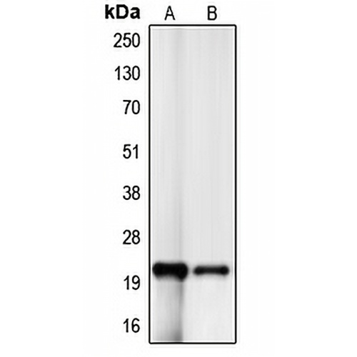 p21 Rabbit Polyclonal Antibody