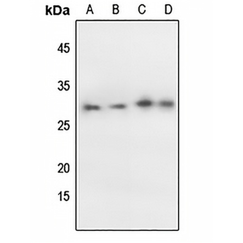p27 Kip1 (Phospho-T198) Rabbit Polyclonal Antibody