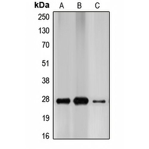 p27 Kip1 Rabbit Polyclonal Antibody
