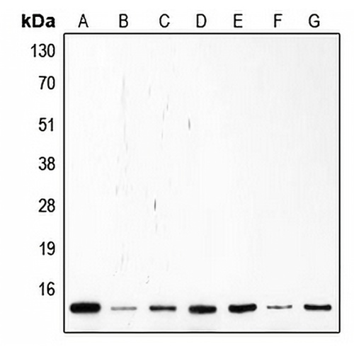 p14 ARF Rabbit Polyclonal Antibody