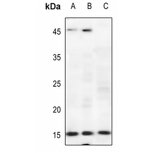 p15 INK4b Rabbit Polyclonal Antibody