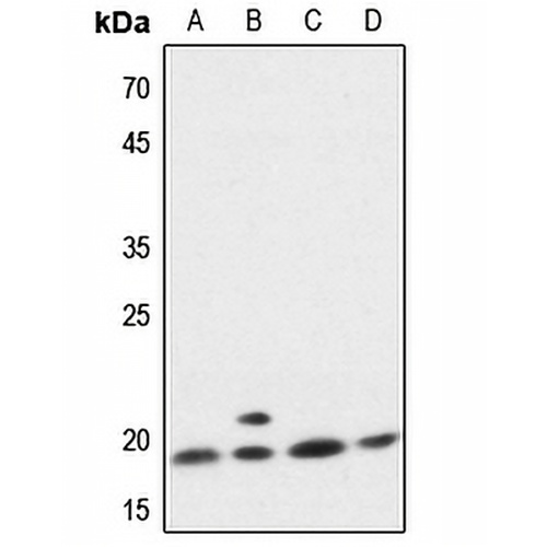 p18 INK4c Rabbit Polyclonal Antibody