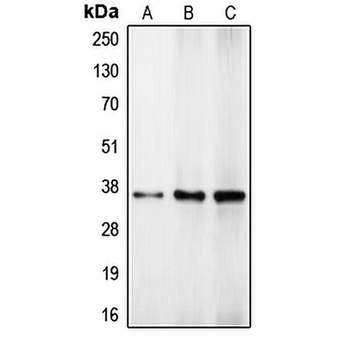 C/EBP beta Rabbit Polyclonal Antibody