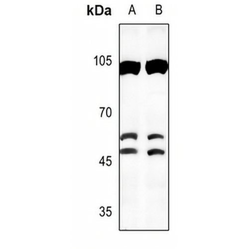 C/EBP beta Rabbit Polyclonal Antibody