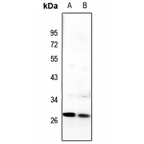 C/EBP delta/epsilon Rabbit Polyclonal Antibody