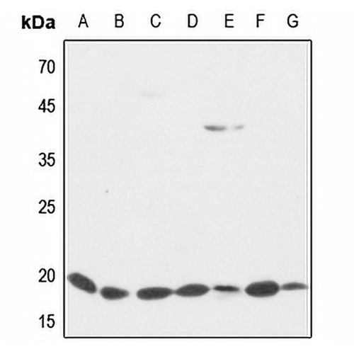 Cofilin Rabbit Polyclonal Antibody