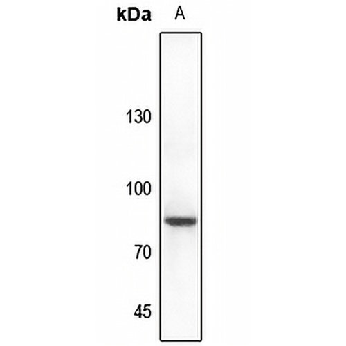 CHAT Rabbit Polyclonal Antibody