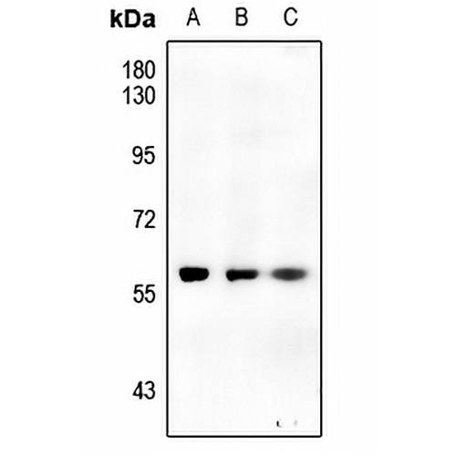 CHK1 (Phospho-S317) Rabbit Polyclonal Antibody