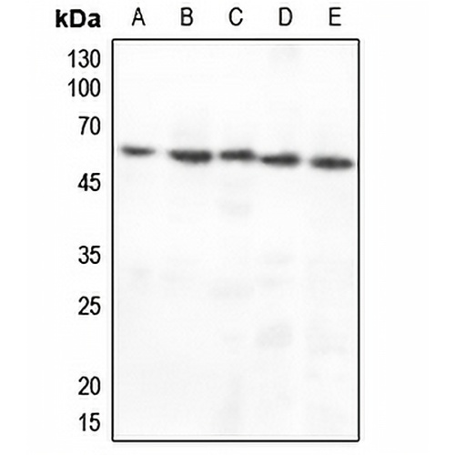 CHK1 Rabbit Polyclonal Antibody