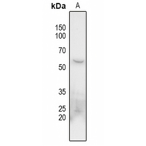 CHK1 Rabbit Polyclonal Antibody