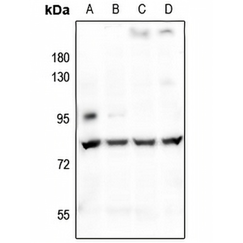 CHML Rabbit Polyclonal Antibody