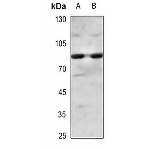 IKK alpha/beta (Phospho-S180/181) Rabbit Polyclonal Antibody
