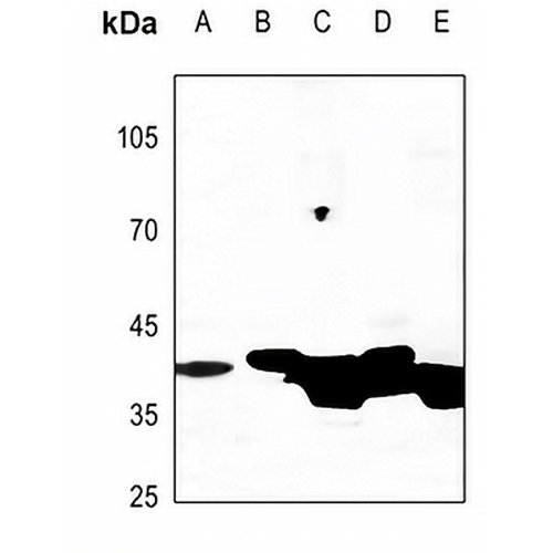 Creatine Kinase M Rabbit Polyclonal Antibody