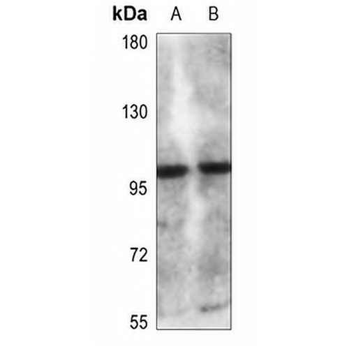 CLCN6 Rabbit Polyclonal Antibody
