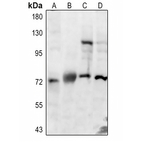 CLCN7 Rabbit Polyclonal Antibody