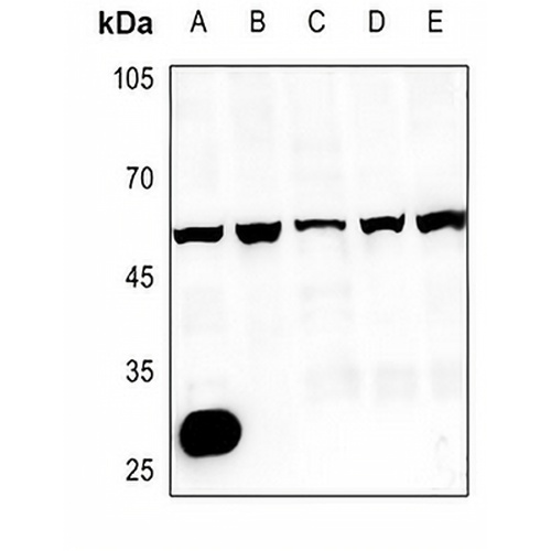 CMKLR1 Rabbit Polyclonal Antibody