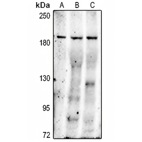 MRP2 Rabbit Polyclonal Antibody