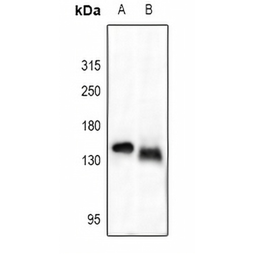 Collagen 1 alpha 2 Rabbit Polyclonal Antibody