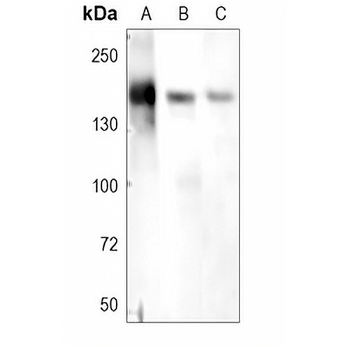 Collagen 1 alpha 2 Rabbit Polyclonal Antibody