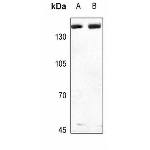 Collagen 3 alpha 1 Rabbit Polyclonal Antibody