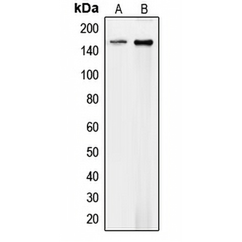 Collagen 4 alpha 1 Rabbit Polyclonal Antibody