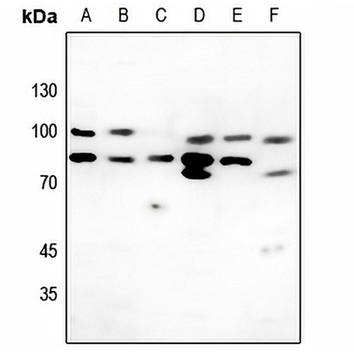 Collagen 6 alpha 2 Rabbit Polyclonal Antibody