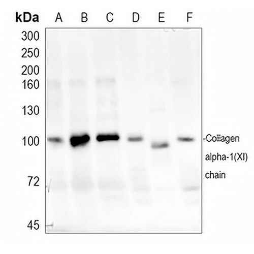 Collagen 11 alpha 1 Rabbit Polyclonal Antibody