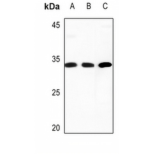 COMT Rabbit Polyclonal Antibody