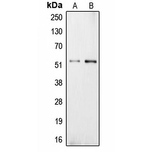 Carboxypeptidase E Rabbit Polyclonal Antibody