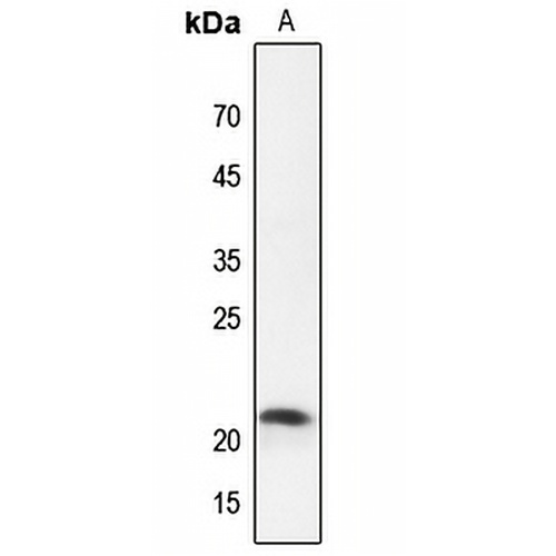 Claudin 4 Rabbit Polyclonal Antibody