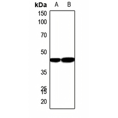 Carboxypeptidase N 1 Rabbit Polyclonal Antibody