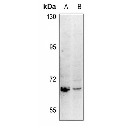 Carboxypeptidase N 2 Rabbit Polyclonal Antibody