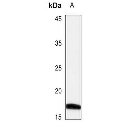 CRABP2 Rabbit Polyclonal Antibody